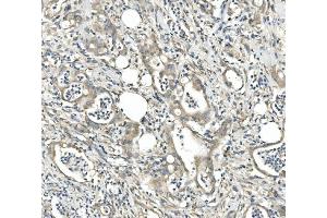 IHC analysis of CDR2 using anti-CDR2 antibody (ABIN7599397).