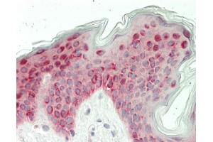 Human Skin: Formalin-Fixed, Paraffin-Embedded (FFPE)