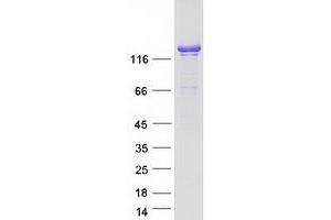 Validation with Western Blot (HMHA1 Protein (Myc-DYKDDDDK Tag))