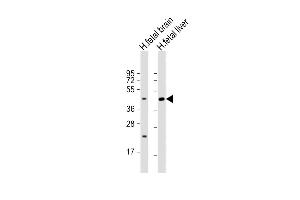 All lanes : Anti-SLC30A10 Antibody (C-term) at 1:2000 dilution Lane 1: human fetal brain lysate Lane 2: human fetal liver lysate Lysates/proteins at 20 μg per lane. (SLC30A10 antibody  (AA 331-359))