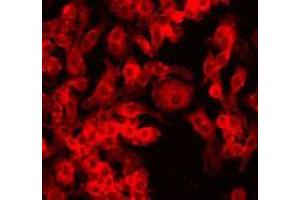 Staining of HIF1A (red dye 568) in a cultured Raw 264. (HIF1A antibody  (AA 329-530))