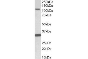 ABIN2561660 (1µg/ml) staining of Human Hippocampus lysate (35µg protein in RIPA buffer). (KIT antibody  (Internal Region))
