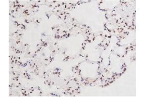 Immunohistochemistry (IHC) image for anti-Microtubule-Associated Protein tau (MAPT) (pSer235) antibody (ABIN6256205)