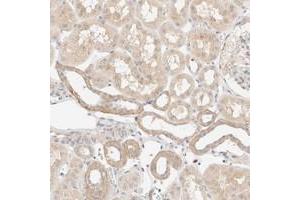 Immunohistochemical staining of human kidney with SNTB1 polyclonal antibody  shows weak cytoplasmic positivity in tubular cells at 1:10-1:20 dilution. (SNTB1 antibody)