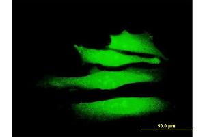 Immunofluorescence of monoclonal antibody to SMARCA2 on HeLa cell. (SMARCA2 antibody  (AA 659-735))
