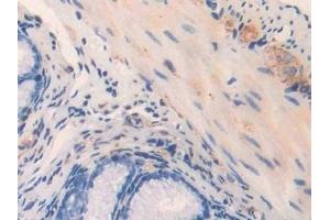 Detection of MYL3 in Mouse Rectum Tissue using Polyclonal Antibody to Myosin Light Chain 3, Alkali, Ventricular, Slow Skeletal (MYL3)
