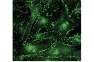 Immunostaining of primary RPE cells With CX43 Ab  at 1/100 dilution. (Connexin 43/GJA1 antibody  (C-Term))