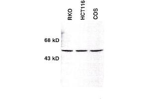 Image no. 1 for anti-Checkpoint Kinase 1 (CHEK1) (AA 1-474) antibody (ABIN264916)