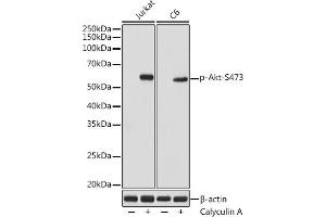 Western blot analysis of extracts of various cell lines, using Phospho-Akt-S473 antibody (ABIN7265522) at 1:1000 dilution. (AKT 1/2/3 antibody  (pSer472))
