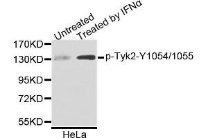 Western blot analysis of extracts of HeLa cells, using Phospho-Tyk2-Y1054/1055 antibody. (TYK2 antibody)