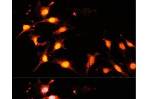 Immunofluorescence (IF) image for anti-K(lysine) Acetyltransferase 2A (KAT2A) antibody (ABIN7260323)