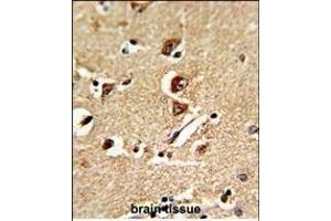 Formalin-fixed and raffin-embedded human brain tissue reacted with GNT Antibody (C-term), which was peroxidase-conjugated to the secondary antibody, followed by DAB staining. (GNPAT antibody  (C-Term))