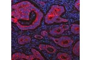 IF analysis of Cytokeratin 20/Krt20 using anti-Cytokeratin 20/Krt20 antibody (ABIN7601133). (KRT20 antibody  (AA 29-431))