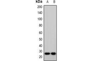 Western blot analysis of IMP3 expression in Hela (A), HepG2 (B) whole cell lysates. (IMP3 antibody  (C-Term))