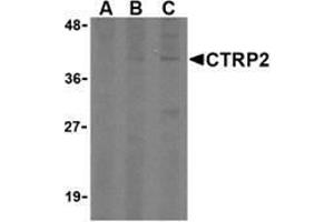 Western blot analysis of CTRP2 in 3T3 (Balb) cell lysate with AP30248PU-N CTRP2 (IN) antibody at (A) 1, (B) 2, and (C) 4 μg/ml. (C1QTNF2 antibody  (Intermediate Domain))
