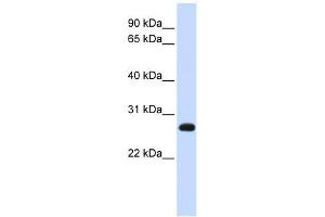 SNAP23 antibody used at 1 ug/ml to detect target protein. (SNAP23 antibody  (N-Term))