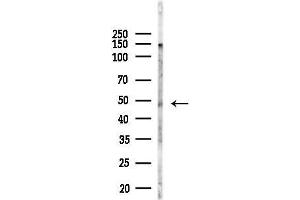 anti-Oxoeicosanoid Receptor 1 (OXER1) antibody