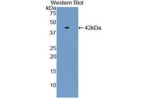 WB of Protein Standard: different control antibodies against Highly purified E. (VTCN1 ELISA Kit)