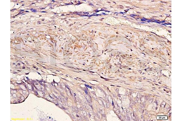 ZBTB7A antibody  (AA 151-250)