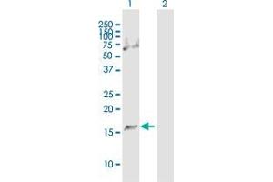 Western Blotting (WB) image for anti-C1D Nuclear Receptor Corepressor (C1D) (AA 1-141) antibody (ABIN2565382)