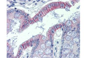 Anti-DSG2 antibody IHC of human colon. (Desmoglein 2 antibody  (AA 72-121))