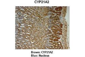 Sample Type : Monkey adrenal gland  Primary Antibody Dilution :  1:25  Secondary Antibody: Anti-rabbit-HRP  Secondary Antibody Dilution:  1:1000  Color/Signal Descriptions: Brown: CYP21A2 Blue: Nucleus  Gene Name: CYP21A2  Submitted by: Jonathan Bertin, Endoceutics Inc. (CYP21A2 antibody  (C-Term))