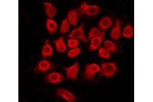 ABIN6272438 staining HepG2 by IF/ICC. (SS18 antibody  (N-Term))