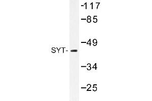 Image no. 1 for anti-Synaptotagmin I (SYT1) antibody (ABIN272235)