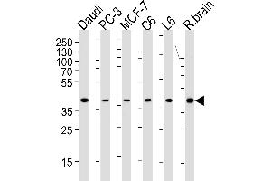 CREB3L4 Antibody (M01) (ABIN1882047 and ABIN2838479) western blot analysis in Daudi,PC-3,MCF-7,rat C6 and L6 cell line ,rat brain tissue lysates (35 μg/lane). (CREB3L4 antibody  (AA 1-300))