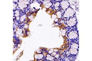 Immunohistochemistry (Paraffin-embedded Sections) (IHC (p)) image for anti-Endonuclease VIII-Like 1 (NEIL1) antibody (ABIN7073820)