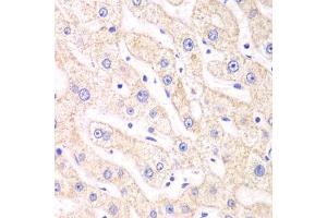 Immunohistochemistry of paraffin-embedded human liver injury using PSMF1 antibody (ABIN5973235) at dilution of 1/100 (40x lens). (PSMF1 antibody)