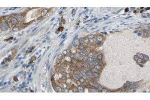ABIN6277086 at 1/100 staining Human prostate tissue by IHC-P. (PDE1B antibody  (C-Term))
