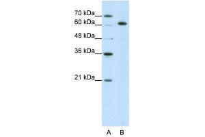 SNRP70 antibody used at 5 ug/ml to detect target protein. (SNRNP70 antibody)