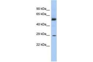 Image no. 1 for anti-Glutathione S-Transferase mu 3 (Brain) (GSTM3) (AA 143-192) antibody (ABIN6743751) (GSTM3 antibody  (AA 143-192))
