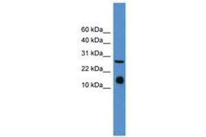 Image no. 1 for anti-Interleukin 5 (IL5) (AA 21-70) antibody (ABIN6746379) (IL-5 antibody  (AA 21-70))