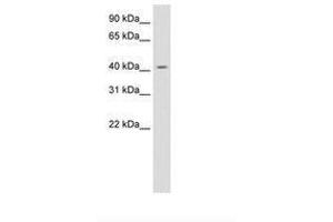 Image no. 1 for anti-Jun D Proto-Oncogene (JUND) (AA 273-322) antibody (ABIN6736130) (JunD antibody  (AA 273-322))