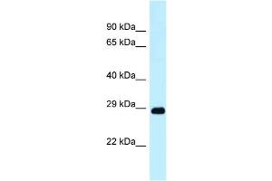 WB Suggested Anti-Dram1 Antibody Titration: 1.