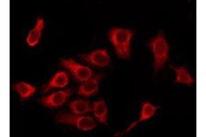 ABIN6276266 staining MCF7 by IF/ICC. (OR5D16 antibody  (Internal Region))