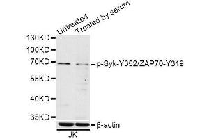 Western blot analysis of extracts of Jurkat cells, using Phospho-Syk-Y352/ZAP70-Y319 antibody (ABIN5996169) at 1/1000 dilution. (SYK antibody  (pTyr319, pTyr352))