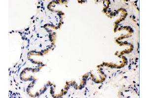 IHC testing of FFPE rat lung with COMT antibody. (COMT antibody  (AA 52-271))