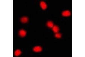 Immunofluorescent analysis of MDM2 staining in NIH3T3 cells. (MDM2 antibody)