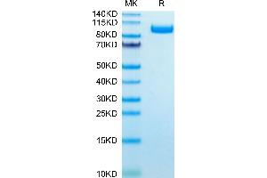 Mouse PSMA on Tris-Bis PAGE under reduced condition. (PSMA Protein (AA 45-752) (His tag))