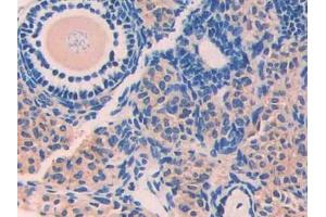 Used in DAB staining on fromalin fixed paraffin- embedded stomach tissue (Factor VII antibody  (AA 315-433))