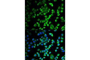 Immunofluorescence analysis of HeLa cells using SERPINH1 antibody (ABIN5971349). (SERPINH1 antibody)