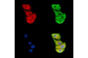 ABIN6262399 and ABIN6278869 staining Hela cells by IF/ICC. (HSPA9 antibody  (C-Term))