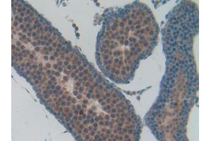 IHC-P analysis of Rat Testis Tissue, with DAB staining. (Osteocalcin antibody  (AA 11-98))