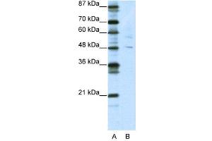 WB Suggested Anti-PLAGL1  Antibody Titration: 5. (PLAGL1 antibody  (N-Term))