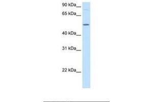 Image no. 2 for anti-Betaine--Homocysteine S-Methyltransferase (BHMT) (AA 49-98) antibody (ABIN320645) (BHMT antibody  (AA 49-98))