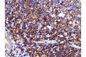 Immunohistochemistry of paraffin-embedded human appendix using PI3 Kinase p85 alpha Rabbit mAb (ABIN7269319) at dilution of 1:100 (40x lens). (PIK3R1 antibody)