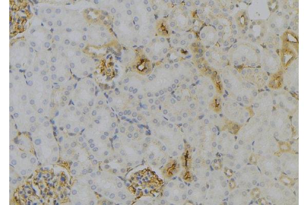 MT-ND6 antibody